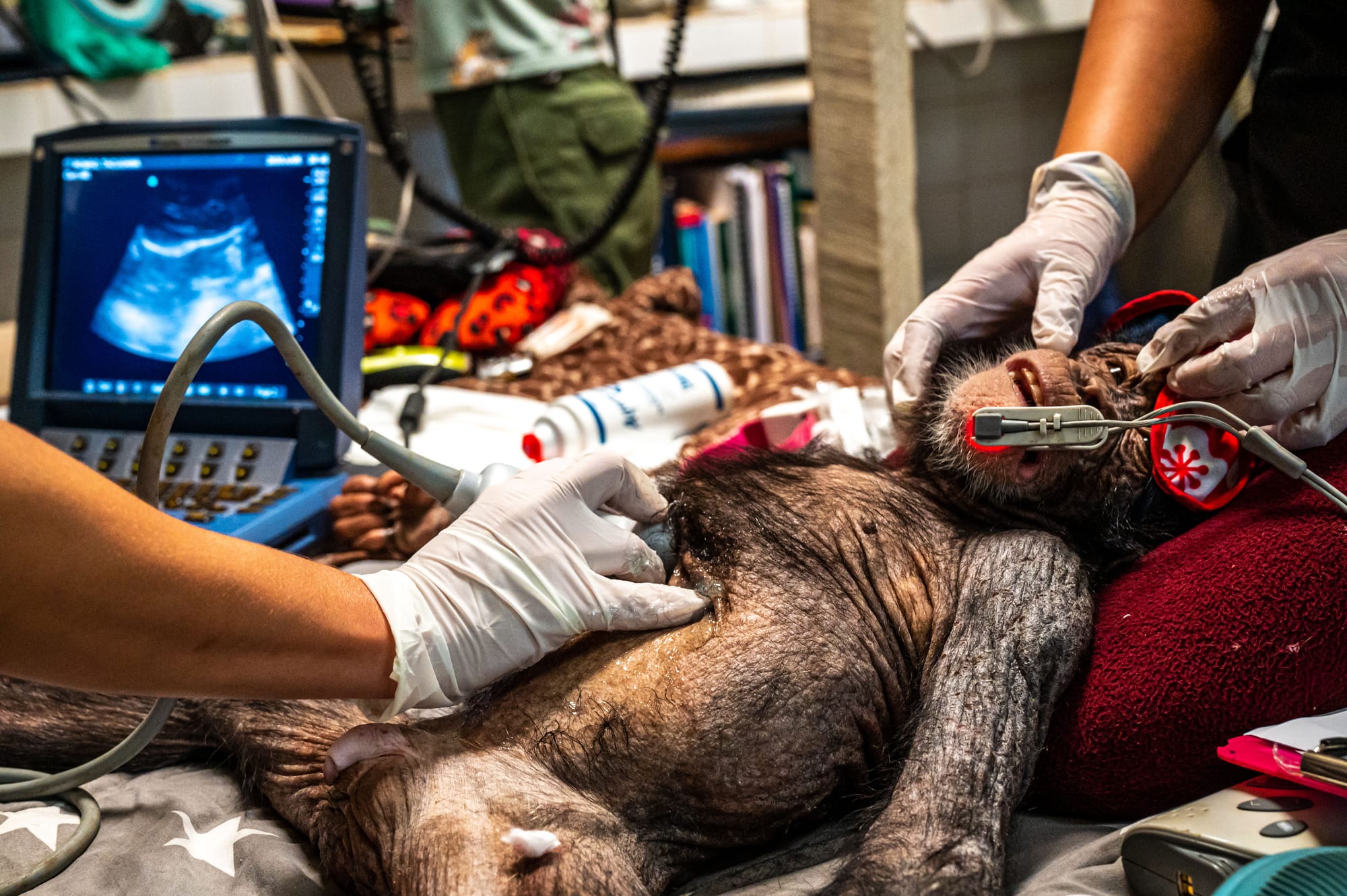 a chimpanzee receiving medical treatment care from doctors